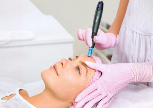 Quick Guide to Microneedling: Why Professionals Recommend It