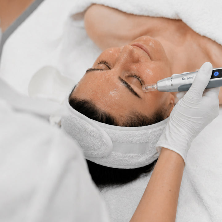 Close-up of a professional microneedling facial treatment using the Dr. Pen MC9 Ultima PRO device on a client’s cheek in a skincare clinic.
