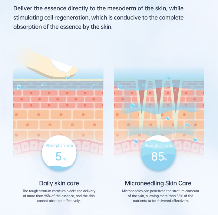 Illustration of essence absorption of microneedling skincare 